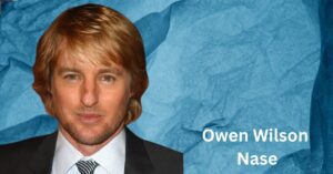 Owen Wilson Nase